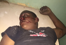 Hombre muere al chocar motocicleta que conducía con una vaca en Maimón